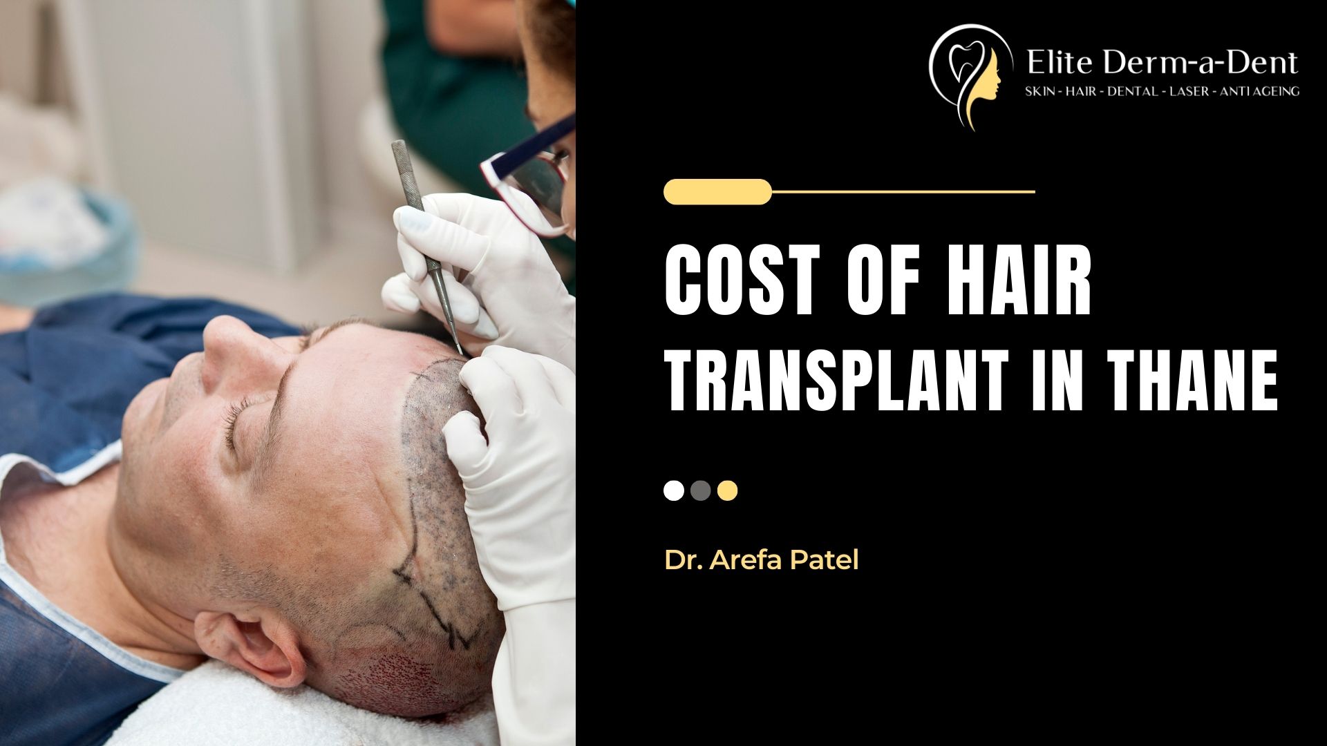 cost of hair transplant in thane