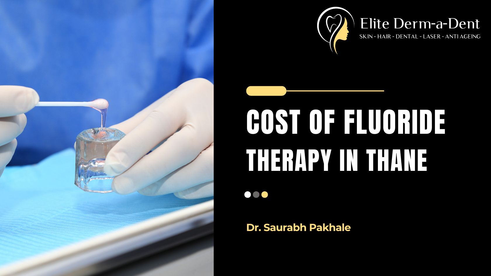 Cost of Fluoride Therapy in Thane