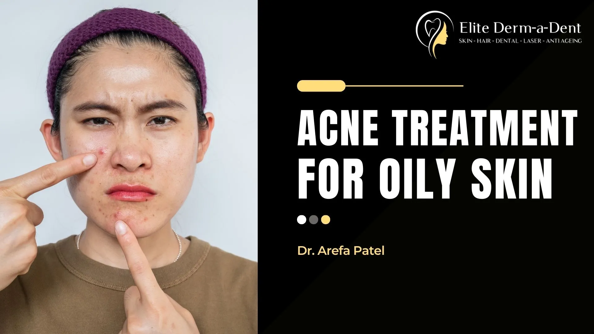 Acne-Treatment-for-Oily-Skin