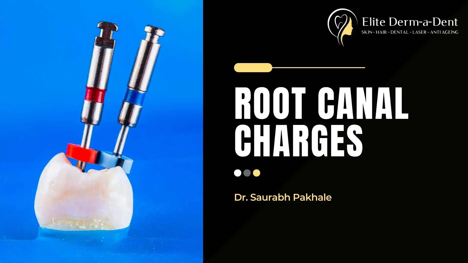 Root Canal Charges in Thane